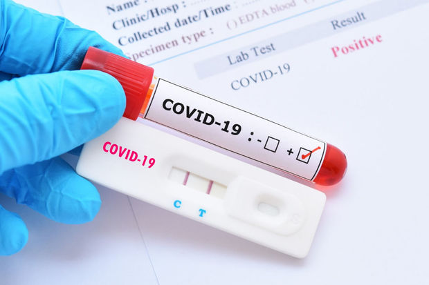 dunyada-son-hefte-qeyde-alinan-qorxulu-koronavirus-statistikasi